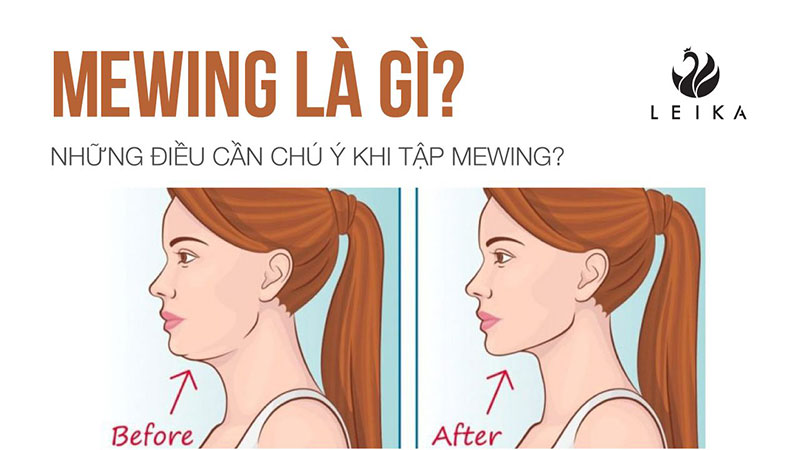 mewing là gì