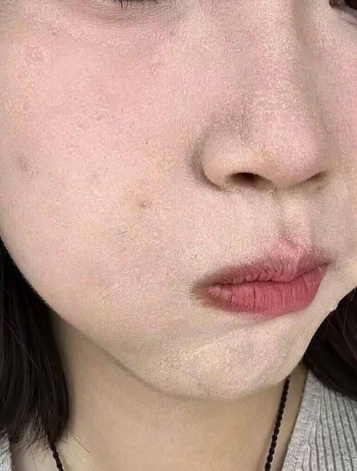 đánh nền bị mốc